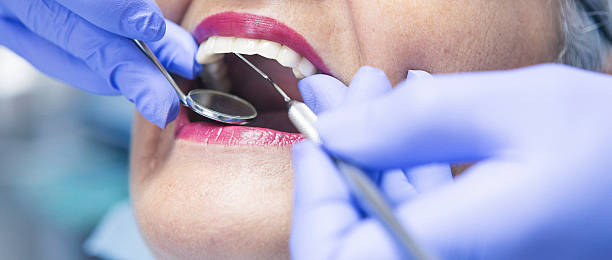 Best Broken or Cracked Tooth Emergency Dentist in Clinton, LA